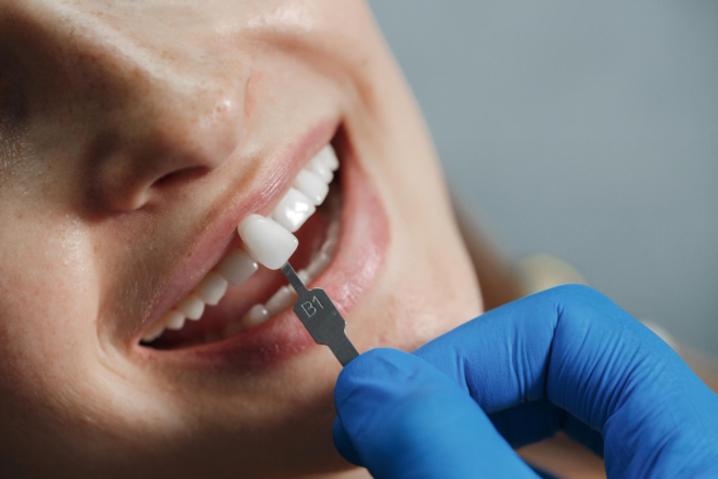 Avances en implantología dental y su impacto en la salud integral