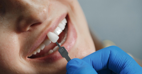 Avances en implantología dental y su impacto en la salud integral